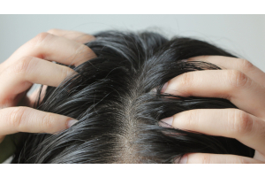 Kui juuste värvimine kipitab või sügeleb, tasub kaaluda taimset juuksevärvi